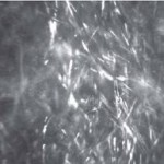 distrofia corneal de Schnyder