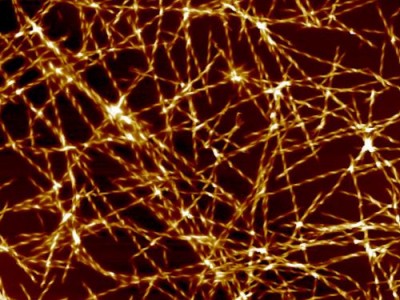 Los científicos identifican disparador molecular de la enfermedad de Alzheimer