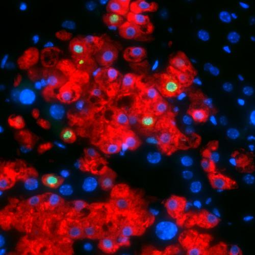 human_fibroblast-derived_hepatocytes