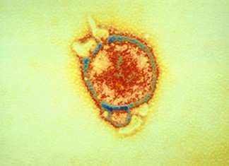 Gran avance en el tratamiento del virus de Hendra