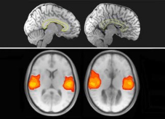 Neurocientíficos investigan comunicación del cerebro