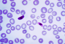 Plasmodium falciparum