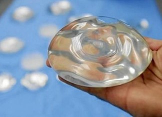 Francia aconseja a 30.000 mujeres a retirar implantes mamarios PIP