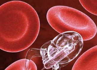 Un estudio identifica una nueva forma de las células del cerebro mueren en la enfermedad de Alzheimer