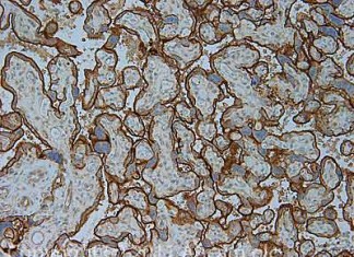 Los científicos trabajan para separar la proteína que el VIH utiliza como escudo de protección