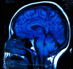 Un compuesto detecta y trata tumores malignos y ciertas células madre del cáncer