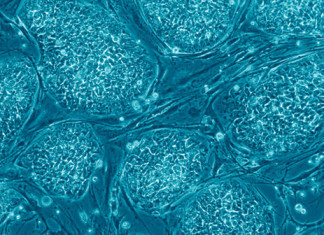 En camino de un mejor tratamiento para la diabetes tipo 1