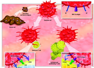 Tremelimumab muestra promesa en el tratamiento del cáncer de hígado
