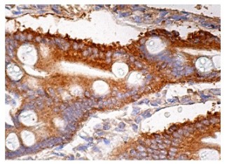 Estudios revela cómo los alimentos altos en grasa impactan la diabetes y el síndrome metabólico