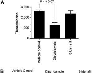 Los límites del crecimiento: los científicos identifican la clave de la metástasis