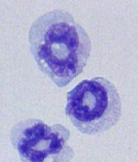 Científicos descubren nuevo tipo de célula con función clave en el asma resistente al tratamiento