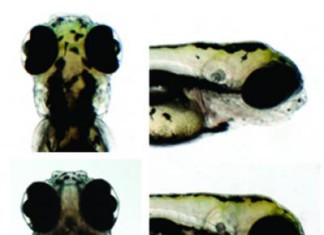 Estudio encuentra el gen relacionado con el autismo, la esquizofrenia y la obesidad