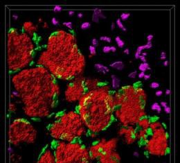 «Una línea roja» alrededor de cáncer de mama