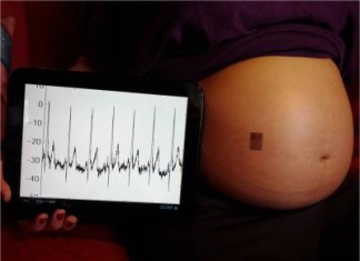 La electrónica epidérmica para el monitoreo continuo del embarazo.
