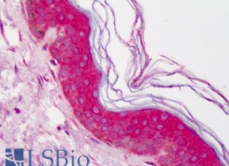 ¿Por qué las células grasas engordan?