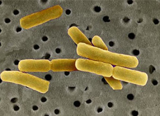 Más casos de antrax en Georgia
