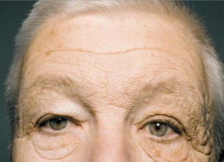 ¿Que nos hace realmente la exposición solar? (Imagen)