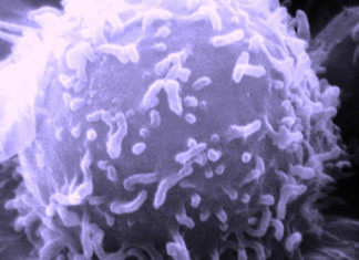 Privación de glucosa activa bucle de retroalimentación que mata las células cancerosas: estudio