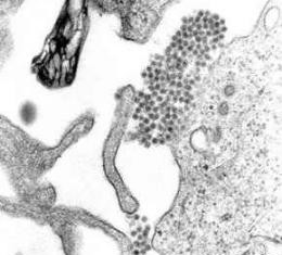 Aislados los anticuerpos humanos para el virus del dengue