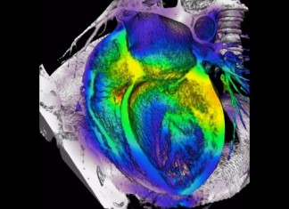 Informe sobre el uso de prueba vascular en pacientes con enfermedad arterial
