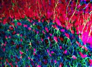 Un nuevo medicamento que puede revertir los síntomas de la enfermedad de Huntington