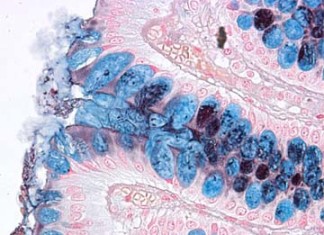 Los microbios del intestino luchan contra un conjunto común de virus en el mundo