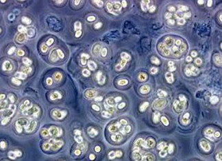 El mundo complejo de los microbios ayudan en el peso corporal