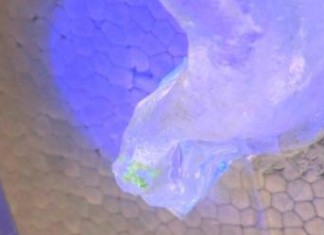 Los anticuerpos pueden revertir la diabetes tipo 1 en un nuevo estudio sobre inmunoterapia