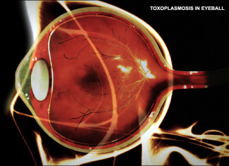 Las mujeres infectadas por Toxoplasma gondii tienen un mayor riesgo de intento de suicidio