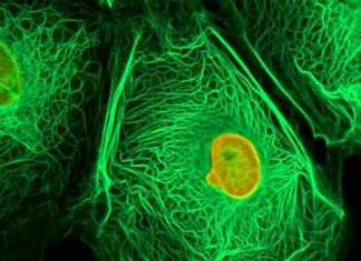 Nueva terapia para el cáncer de mama triple negativo