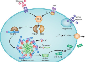 Descubierta molécula que causa la diabetes, TXNIP