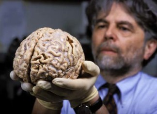 El aumento y la evolución del cerebro humano en comparación con los otros animales