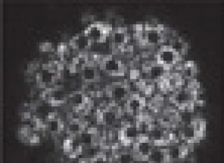 Estudio «orgánico» de tejido pancreático vivo da nuevas oportunidades para la investigación de la diabetes