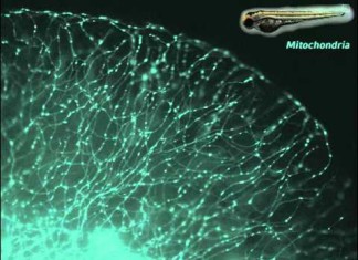 La cura para la enfermedad de Alzheimer puede ser una cuestión de tamaño