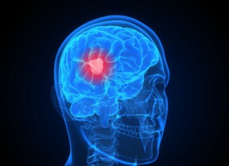 Investigando las propiedades anticancerígenas del cannabis