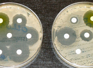 Nueva diana en la lucha contra la ‘superbacteria’