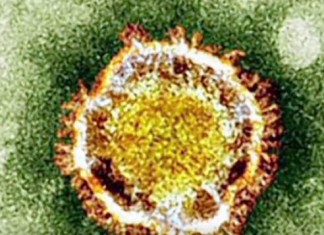 Reino Unido registra nueva muerte por virus MERS