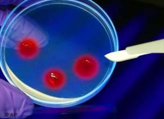 Nueva clase de medicamentos reduce el colesterol en la primera prueba en humanos