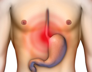 Como reducir la Acidez Gastrica