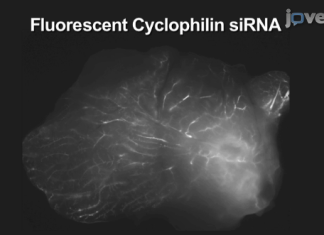 Tratamiento del cáncer de mama a través de la inyección en el pezón