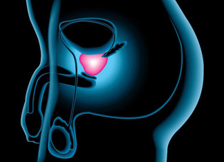 Enzalutamide añade cinco meses de supervivencia en el cáncer de próstata en etapa tardía