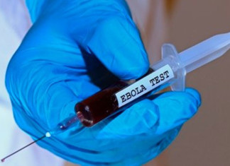 Ébola: nuevo compuesto encontrado para la cura de monos