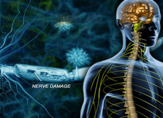 Esclerosis múltiple: expertos piden mayor urgencia en todas las etapas – el tiempo es crítico