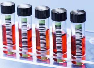 Ataque cardíaco: nueva prueba de sangre puede detectar nivel de riesgo