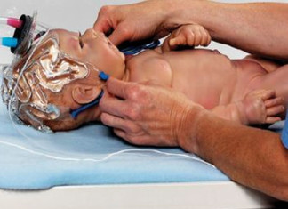 La protección de los cerebros de los recién nacidos mediante la hipotermia