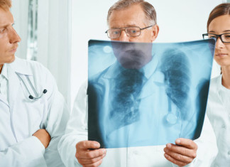 Hipertensión pulmonar: científicos descubren nuevo tipo de células involucradas