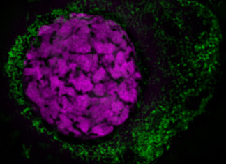 Proteína hepática impulsa el crecimiento de las células productoras de insulina