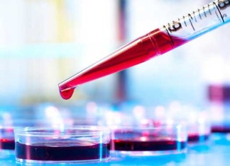 Análisis de sangre detecta todos los genes conocidos de enfermedades cardíacas hereditarias