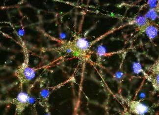 Avance en la esquizofrenia: científicos arrojan luz sobre la causa biológica