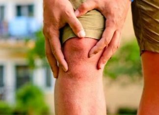 Osteoartritis: Consejos de dieta y para el dolor de rodilla